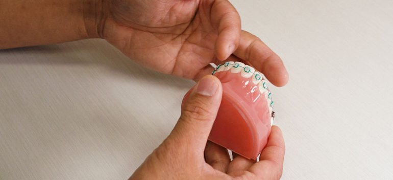 Orange Park FL Ceramic Braces Orthodontist